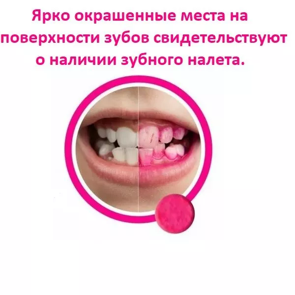 Динал таблетки для индикации зубного налета, 10 шт.